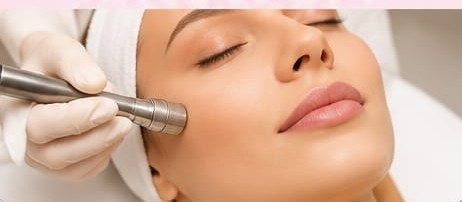 Microdermabrasion